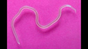 черви в рыбе