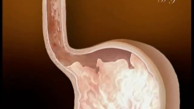 Чудо системы пищеварения смотреть онлайн