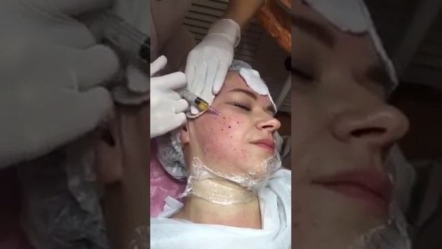 Плазмотерапия. Взгляд изнутри.