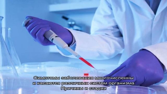 Синдром Рейтера смотреть онлайн