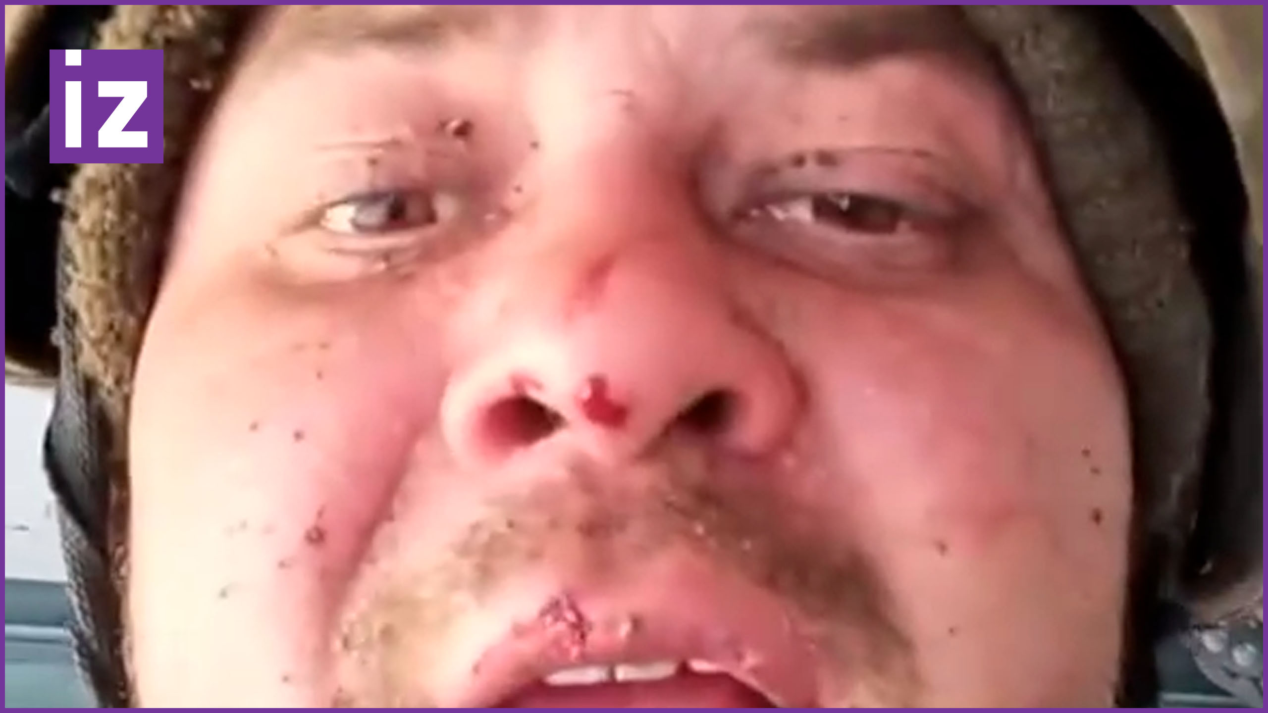 «Мы тактически ушли»: отряд ВСУ отступил из-за увеличения раненых