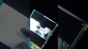 проверка коровы на стельность. демонстрация. клон AcuVista VT98b. от Санбрайт. Sunbright K-S100