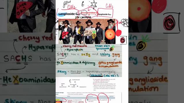 USMLE - Tay–Sachs disease mnemonic смотреть онлайн