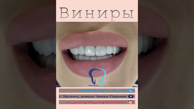 Виниры