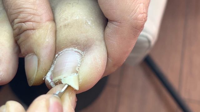 Professional Pedicure: Very Long Toenails!【Pedicure Master Lin Jun】 смотреть онлайн