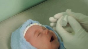 Массаж при дакриоцистите новорожденных