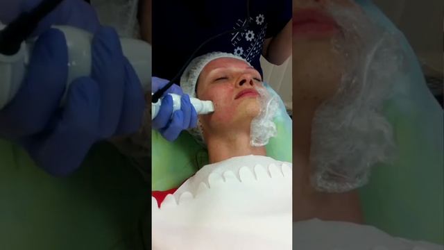 RF Лифтинг смотреть онлайн