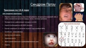 Синдром Патау. Причины, симптомы, диагностика и лечение заболевания