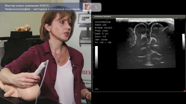 Нейросонография — методика и основные исследования. Мастер-класс Компании Кобусс. смотреть онлайн