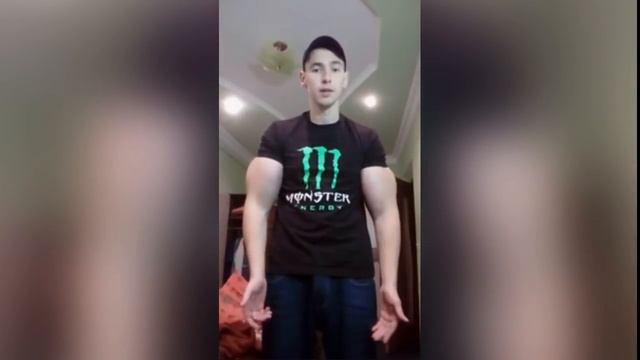 КИРИЛЛ ТЕРЕШИН | АМПУТАЦИЯ РУК | СРОЧНО, СМОТРЕТЬ ВСЕМ!!! КИРИЛЛУ ТЕРЕШИНУ АМПУТИРУЮТ РУКИ!