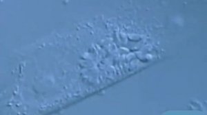 Тип Споровики. Токсоплазма