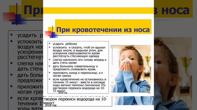 Кровотечение из носа у детей. смотреть онлайн