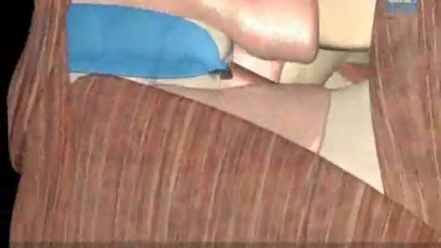 Миофункциональный трейнер схема