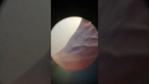 Микроскоп с joom с 40/0.65 *30x нет резкости