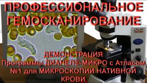 Дианел®-Микро No1 Гемосканирование, Микроскопия Нативной Крови программа для цифровых микроскопов