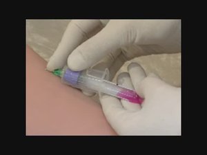 Забор крови из вены