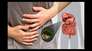 Чем опасна густая желчь и как распознать ее у себя?