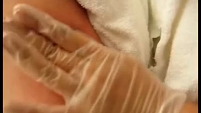 Удаление татуировок лазером смотреть онлайн