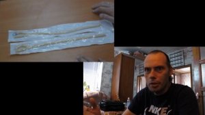 Гастроскопия. Как легко пройти Ф.Г.С. без рвотного рефлекса