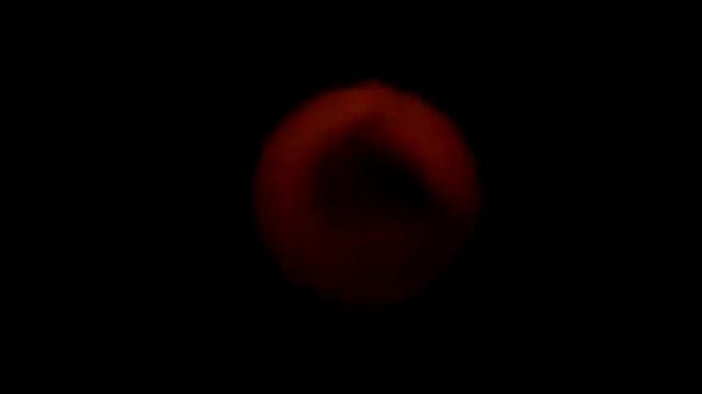Удаление полипа из пищевода