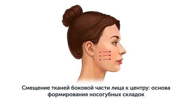 5 причин НОСОГУБНЫХ МОРЩИН и складок: способы устранения