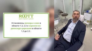 Отзыв пациента о лечении в клинике Roott