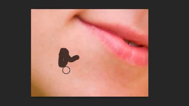 Как убрать прыщи смотреть онлайн