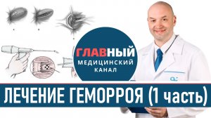 Лечение геморроя (1). Как и чем лечить наружный геморрой. Таблетки, мазь и свечи от геморроя