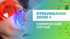 ? Отбеливание zoom 4. Клинический случай