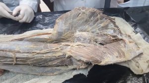 Поясничное и крестцовое сплетение