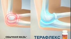 Реклама Терафлекс: Как играть на скрипке без проблем?