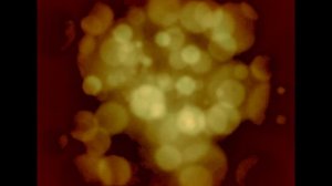 Якорцы стелющиеся (Tribulus Terrestris) и гиполипидемическая активность