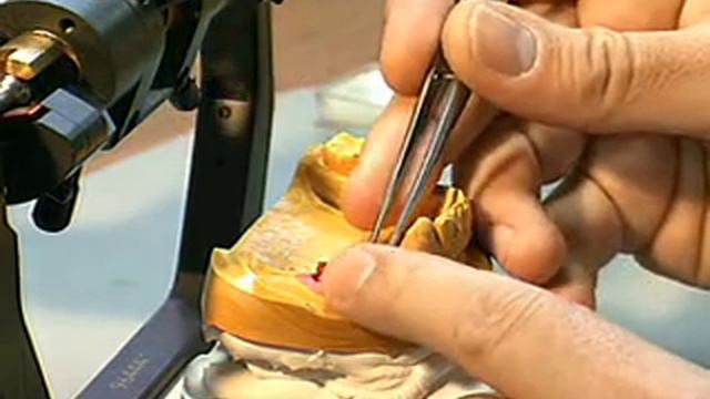 Ортопедический этап имплантации часть 2 смотреть онлайн