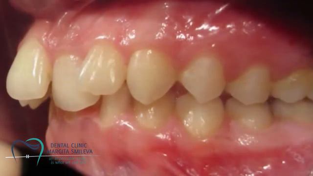 Dental Clinic Crowding ~ смотреть онлайн