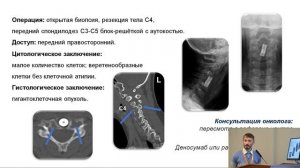 Перезалив VIII Конференция НИИ  НДХиТ  22.02.2020 Зал  "НМП"  Часть 3