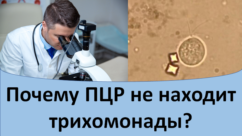 Почему пцр не находит трихомонады