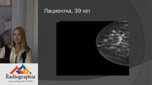 МР-маммография. Интерактивный разбор клинических случаев Екатериной Першиной