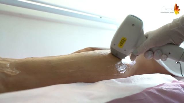 Лазерная эпиляция - Бат Ям смотреть онлайн