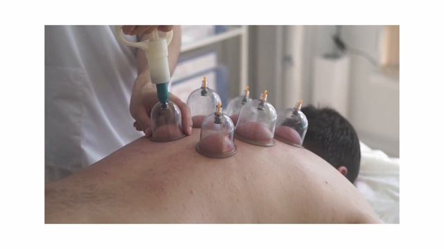 Хиджама Авиценна: массаж спортивный, мануальный, баночный, вакуумный, точечный