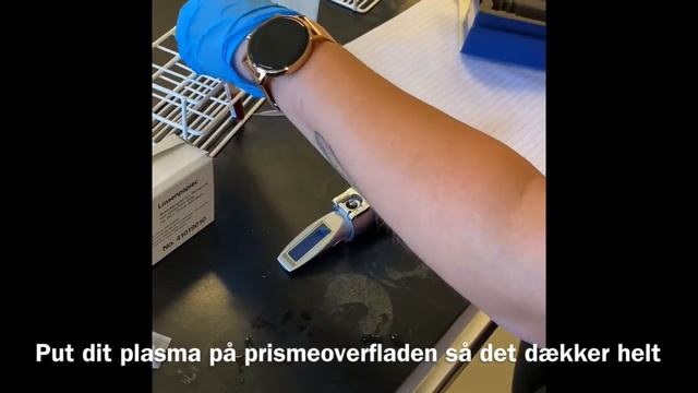 Totalprotein Måling Med Refraktometer På Serum смотреть онлайн