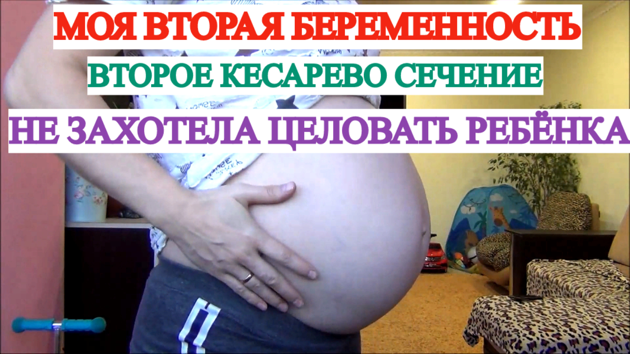МОЯ 2 БЕРЕМЕННОСТЬ? ВТОРОЕ КЕСАРЕВО СЕЧЕНИЕ