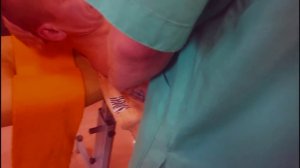 Анатомия мышц лопатки Алексей Воскресенский