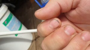 Реакция перекиси водорода на кожу. Насколько опасна перегидроль?