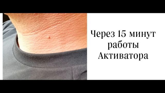 Результат работы косметического прибора Активатор клеток
