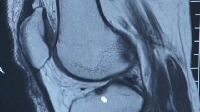 Магнитно-резонансная томография. МРТ смотреть онлайн