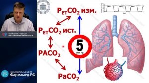 Капнография Лебединский К.М.