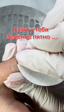 Если у тебя зеленое пятно