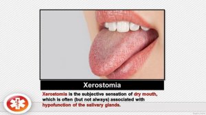 Sertraline SIDE EFFECTS - Sertraline (Zoloft) 50 mg - Prescription Drug