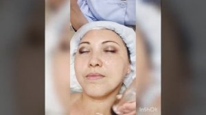 РФ лифтинг лица