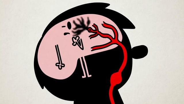 ? Что происходит во время инсульта? [Ted-Ed на русском] смотреть онлайн